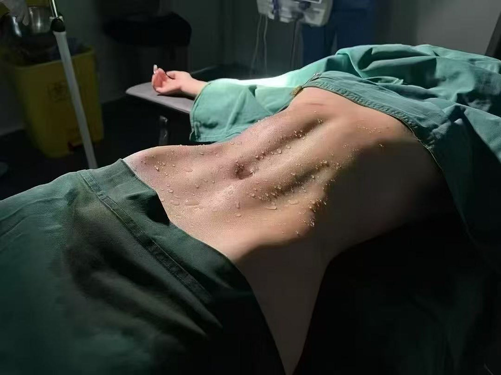 身体塑形案例：正面线条观察